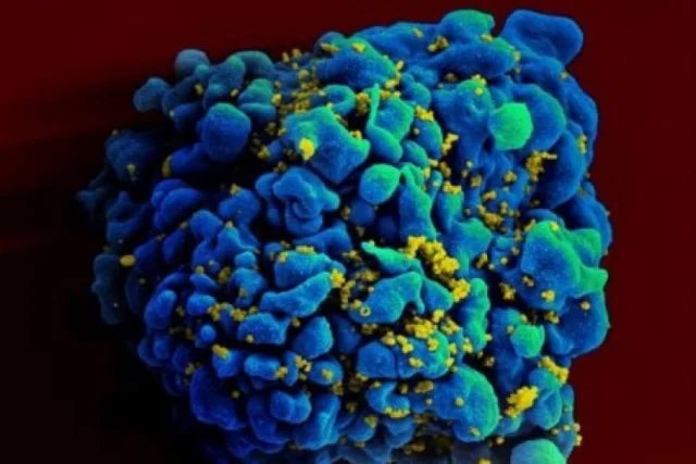 🔥 THỬ NGHIỆM THÀNH CÔNG VACCINE HIV TRÊN ĐỘNG VẬT
----
Các nhà khoa học tại Viện Dị ứng v
