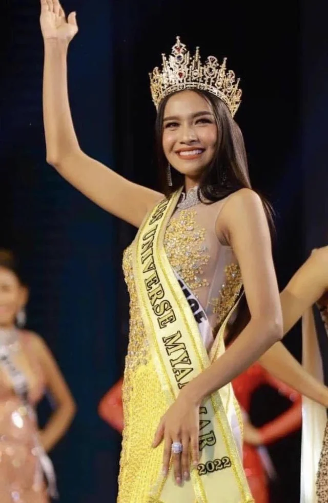 Ngoại hình quyến rũ của tân Hoa hậu Hoàn vũ Myanmar 
========
🔸Người mẫu 20 tuổi Zar Li M
