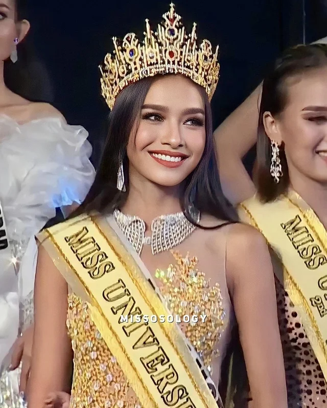 Ngoại hình quyến rũ của tân Hoa hậu Hoàn vũ Myanmar 
========
🔸Người mẫu 20 tuổi Zar Li M