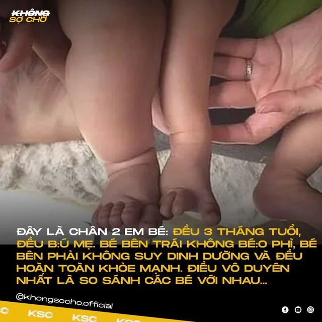 QUAN TRỌNG NHẤT LÀ CON KHỎE MẠNH, ĂN-CHƠI-NGỦ ĐẦY ĐỦĐây là chân của 2 em bé,
Đều 3 tháng t
